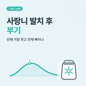사랑니 발치 후 부기 썸네일